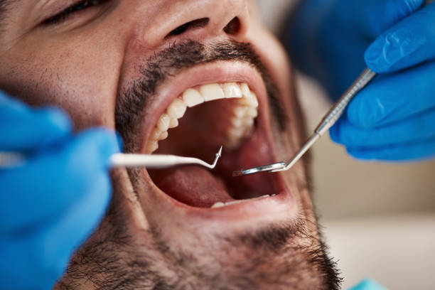 Best After-Hours Emergency Dentist in Johnson Creek, WI